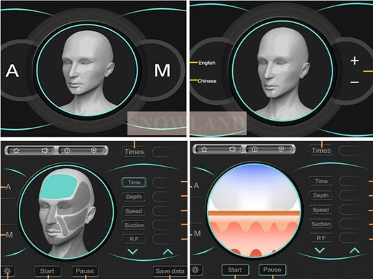 त्वचा संपर्क सेंसर के साथ सेमीकंडक्टर 808nm लेजर डायोड लेजर हेयर रिमूवल मशीन जो तेज़ हेयर रिमूवल उपचार सुनिश्चित करती है
