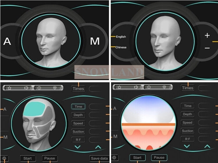 त्वचा संपर्क सेंसर के साथ सेमीकंडक्टर 808nm लेजर डायोड लेजर हेयर रिमूवल मशीन जो तेज़ हेयर रिमूवल उपचार सुनिश्चित करती है